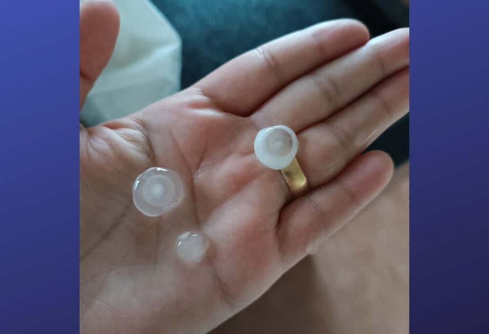 Choveu até granizo no Sul do Estado