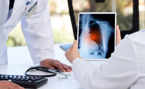 Capacitação de equipe para atender pacientes com tuberculose