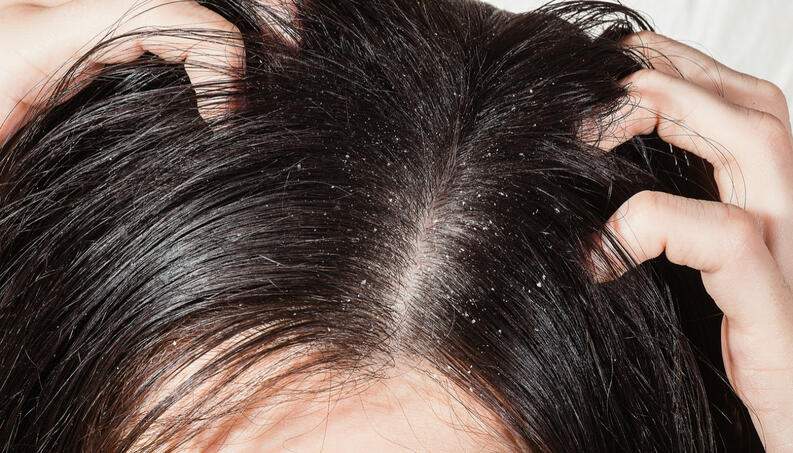 Cabelo pode ser um hospedeiro do novo coronavírus, alerta tricologista