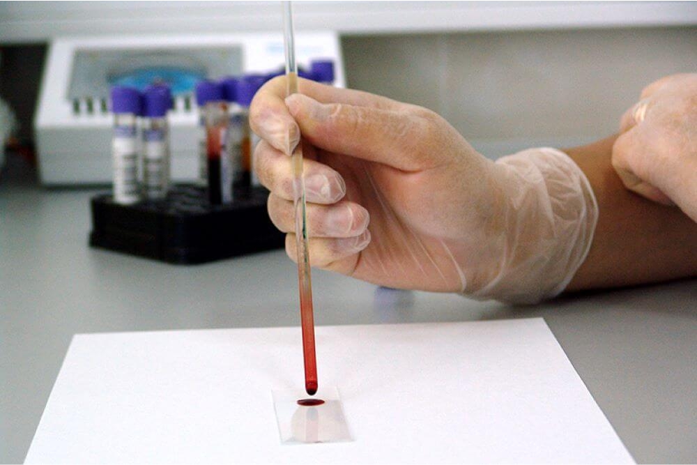Grávida que teve resultado falso positivo para HIV será indenizada em R$ 10 mil