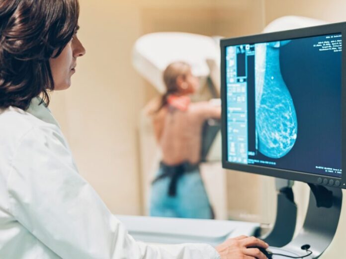 Apenas 16,4% das mulheres do público-alvo para mamografias realizaram o exame em 1 ano no ES