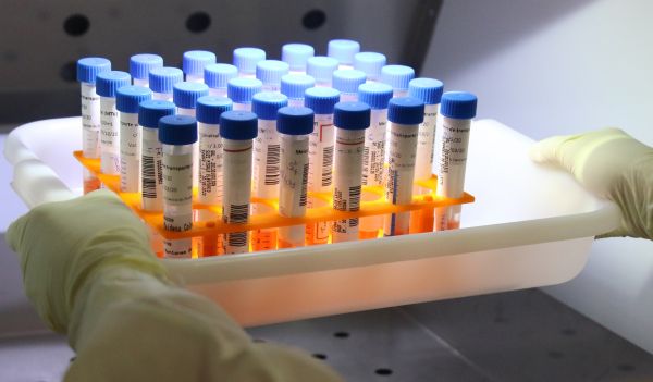 Governo encomenda 100 milhões de doses da vacina de Oxford